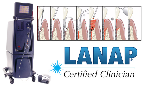 Dumont Dental Professionals | Snoring Appliances, Sleep Apnea and Ceramic Crowns