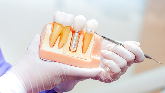 Dumont Dental Professionals | Pediatric Dentistry, Dental Fillings and LANAP reg