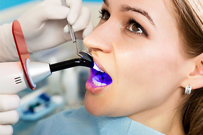 Dumont Dental Professionals | Inlays  amp  Onlays, Dental Fillings and Root Canals