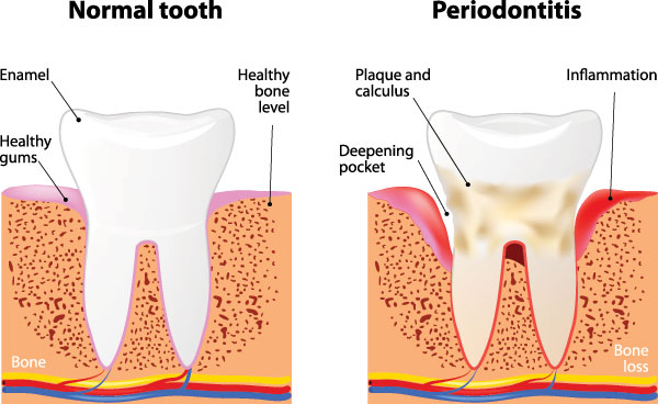 Dumont Dental Professionals | Pediatric Dentistry, Juvederm reg  and Snoring Appliances