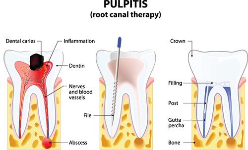 Dumont Dental Professionals | ClearCorrect reg , Night Guards and Extractions